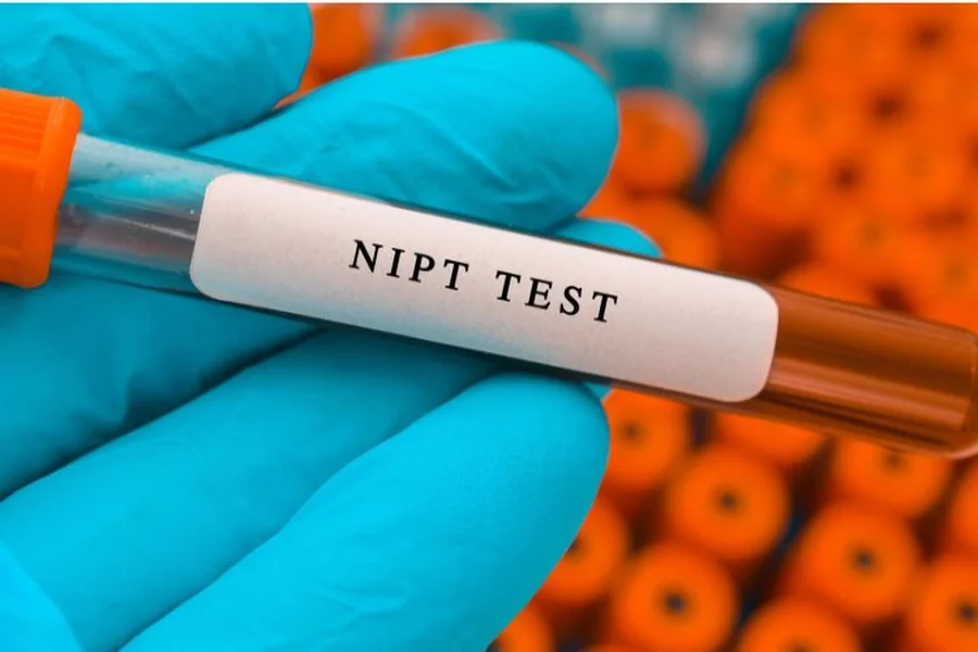 NIPT Test